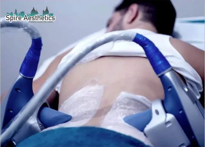 Man having fat freezing treatment done on love handles before a competitions Portland Bill to create a sculpted look.